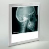 Med&Led Negatoscopio Dental Led 30x30 Lateral De Craneo, Panoramica