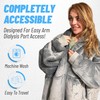 Dialysis Clothing Dialysis Sweatshirts with Arm Zipper | Oversized Wearable