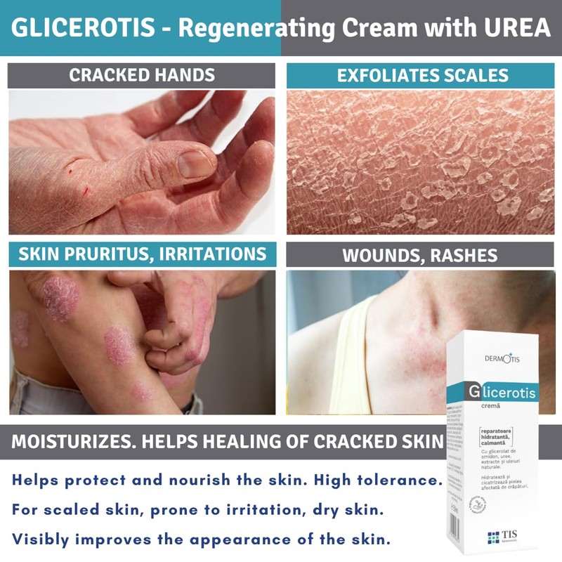 GliceroTIS Cream 50 g - Scars, Keratosis, Psoriasis, Relieving, Moisturising,