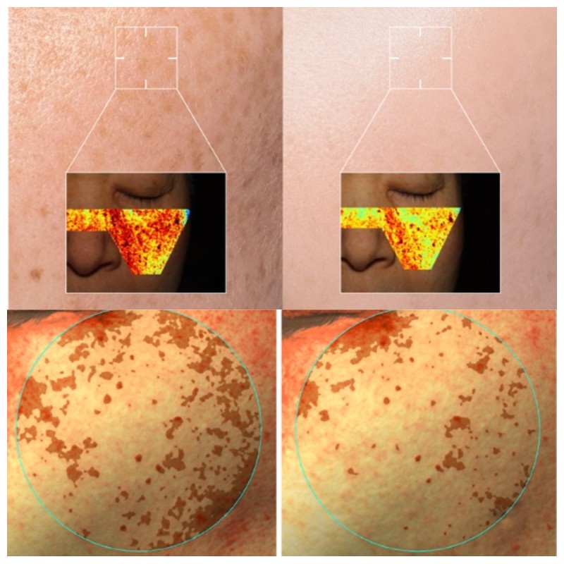 AROCELL Mela TXA Mask 43g*4ea