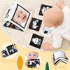 URMYWO Black and White Baby Toys, Tummy Time High Contrast