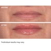 NassifMD Hydro-Screen for Lips - Pink Champagne