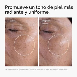 The Ordinary Glycolic Acid 7% Exfoliating Toner, Brightening and Smoothing Daily Toner for More Even-Looking Skin Tone