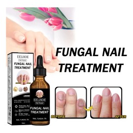 2 Fúngica P Para El Tratamiento De Hongos En Las Uña