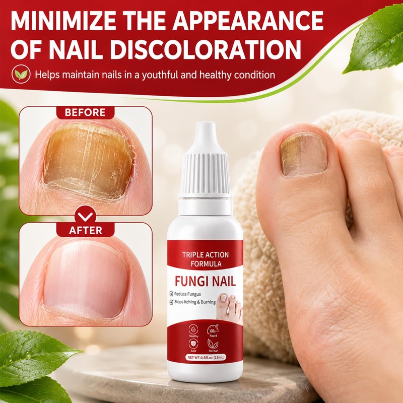 2PCS Fungi Nail ToenailTreatment,Gentle Formula,Effectively lmproves Nails for a More