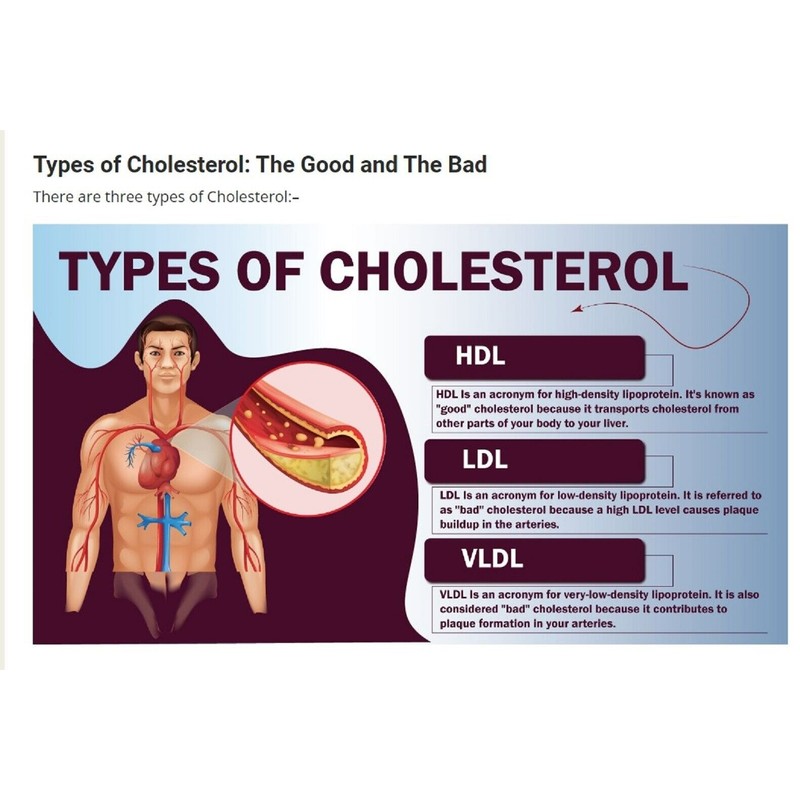 supplements4me CHOLESTEROL BAD REMOVER & FLUSHER ANTIOXIDANT SUPPLEMENT 90 PILL