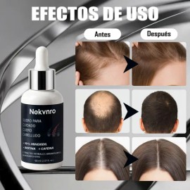 DOVE Sérum Corporal en Crema Niacinamida + Tono Uniforme, cuidado de la piel con manchas, reduce las manchas obscuras y elimina la resequedad 200 ml