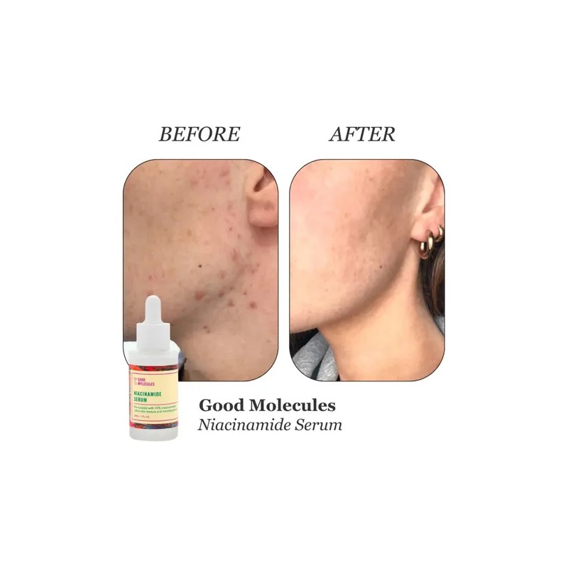 Zlu Srum De Niacinamida Good Molecules - 30 Ml Piel