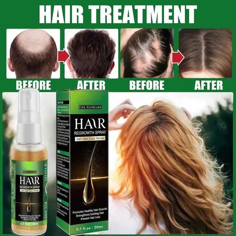 El Sérum Para El Crecimiento Del Cabello Promueve El Crecimi