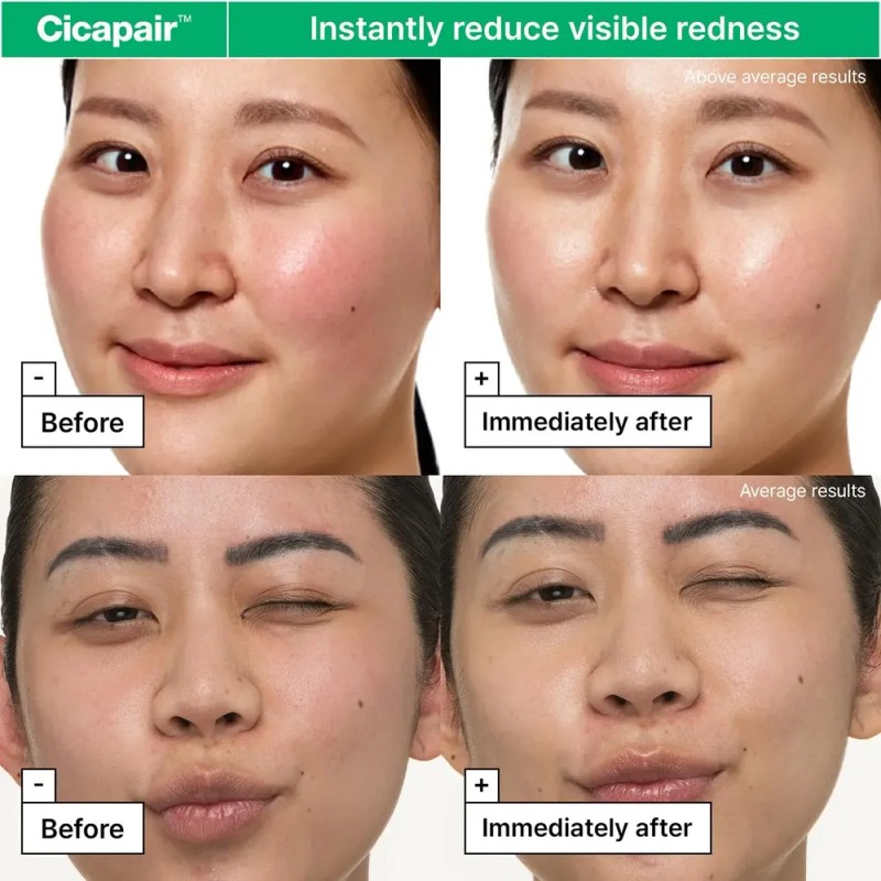 Dr.jart+ Cicapair Crema Hidratante Facial Para Piel Sensible