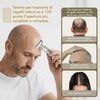 Derma Stamp, Dermastamp Regolabile 0-3mm 120 Titanio Aghi + 64