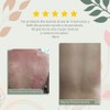 Jabón de Alquitrán para Psoriasis y Eccema, Barra Medicada 2.50