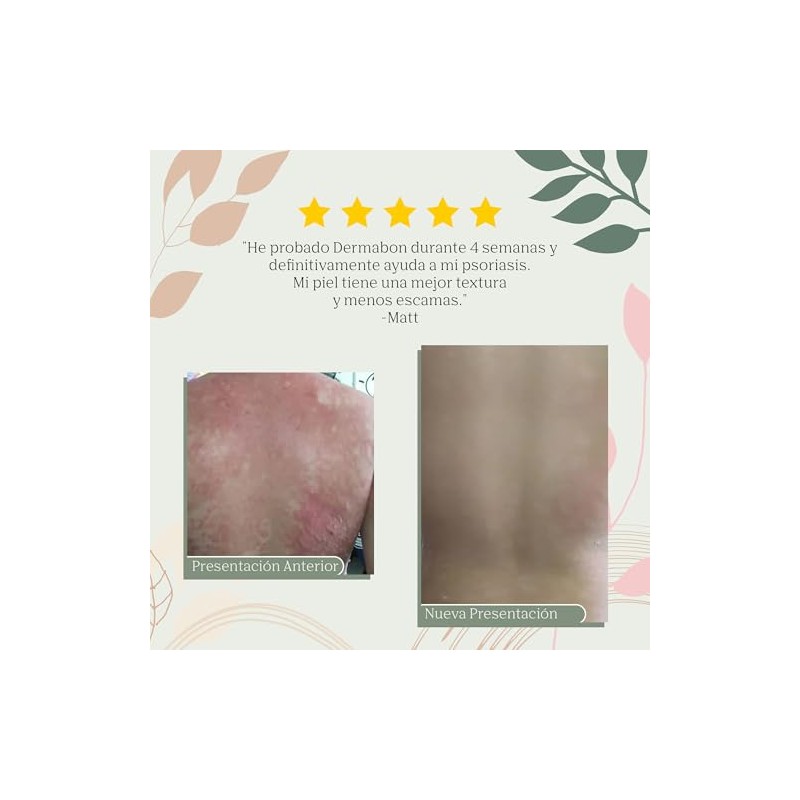 Jabón de Alquitrán para Psoriasis y Eccema, Barra Medicada 2.50