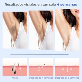 Depilacin Lser Zairuz Ice Cool para Mujeres y Hombres, Dispositivo de Depilacin Ipl para Cuerpo, Rostro, Piernas, Axilas                              
