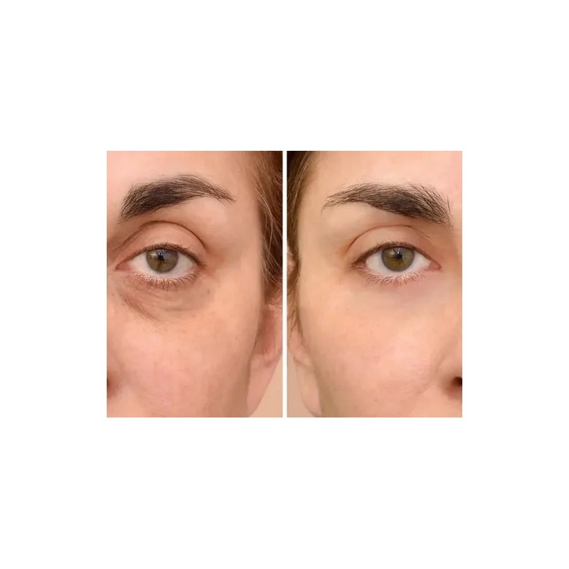 Suero De Cafeína 5% Antiojeras