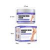 Varicose Veins Cream, Vein Ointment Varicose Veins Cream Against Spider