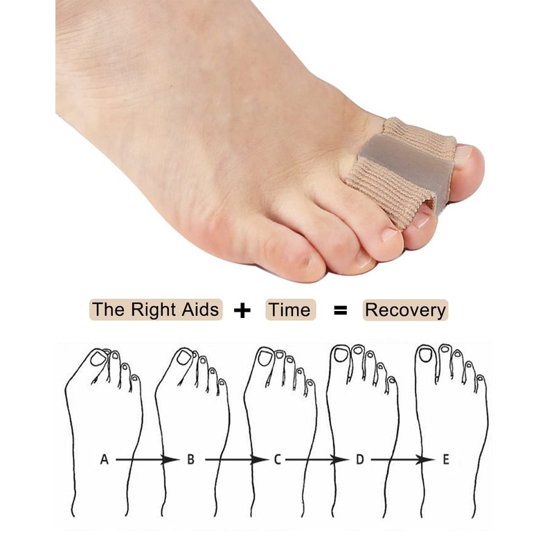 Bunion Toe Separators for Overlapping Toes Women Men, Gel Toe
