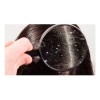 Shampoo Anticaspa Salerm Biokera 1lt