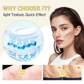 Crema avanzada para cicatrices, gel de silicona para cicatrices, crema profesional para eliminar cicatrices quirúrgicas, estrías, cicatrices antiguas 