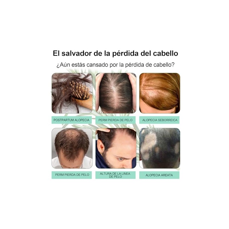 Aceite De RomeroAceite de Romero para El Cabello-100, Aceite Esencial