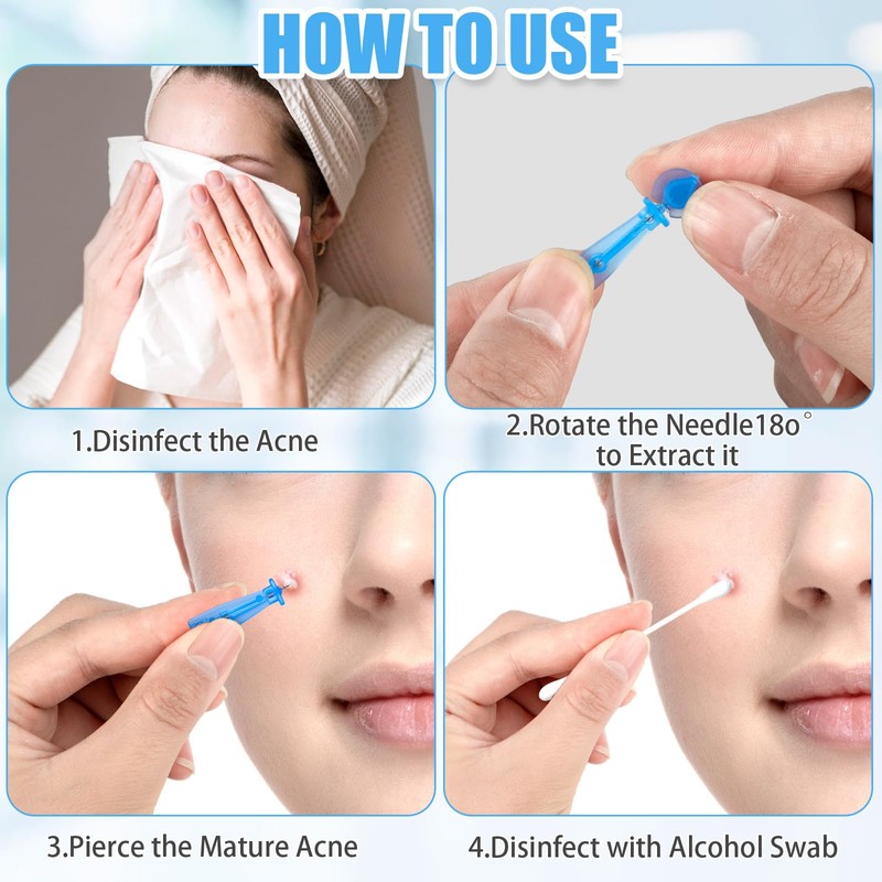 200Pcs Sterile Needles for Pimples, Disposable Acne Needle Effective Blemish