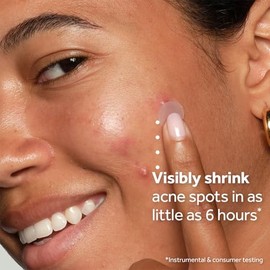 No7 Derm Solutions - Parches de espinillas de ácido salicílico al 2% para cara, tratamiento invisible para piel propensa a manchas, parches para el acné en cuatro tamaños, productos para el cuidado de