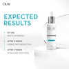 Olay [Value Bundle] BUY 2 GIFT 1 - Olay Luminous