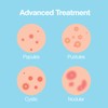 Saplaya K-Beauty Ance Care Hydrocolloid Patches For Acne Pimple Care