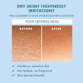 Skin ResQ by Petal Fresh Hello Hydration Cleanser, Daily Gentle Foaming Facial Cleanser with 2% Squalane Complex and Aloe Vera, Fragrance Free Hydrating Face Wash for Dry Sensitive Skin, 10 oz