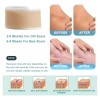 Hojas Silicona Scar Patch 4cm 300cm Cicatrices