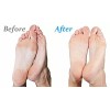 Emjoi Micro Pedi Callus Remover Foot File with Extra Coarse