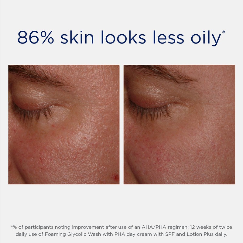 NEOSTRATA Foaming Glycolic Face Wash High Strength AHA Cleanser Soap-free,