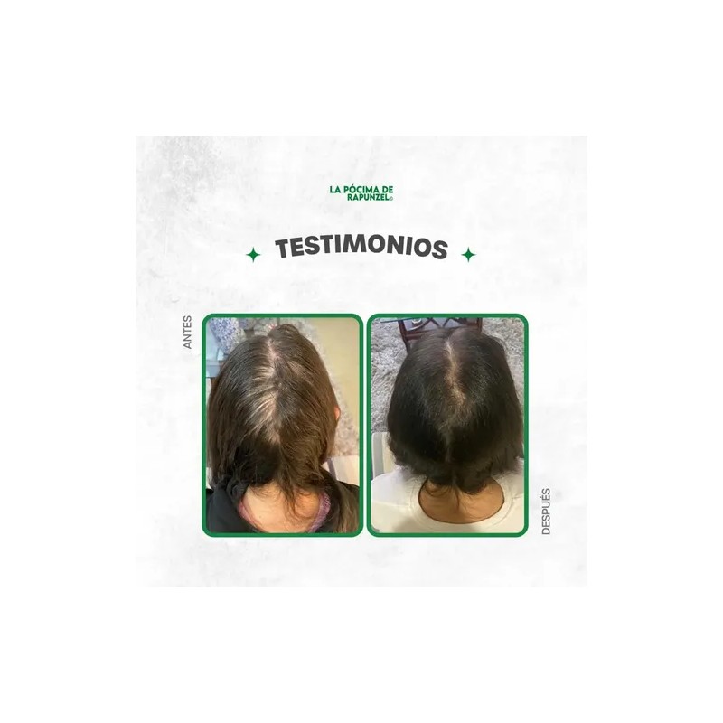 Kit Shampoo Fortificante Anticaída acondicionador De Regalo