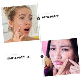 minkissy Daily Skin Care Pastes Hydrocolloid Patch Stickers Large Quantity Invisible Facial Sticker