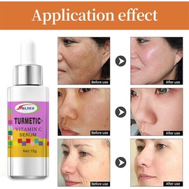 Turmeric Lemon Oil Skin Glow To Lightening Acne Dark Patches Acne Bright Skin Dark Spot Corrector Face Whitening Serum Turmeric Dark Spot Corrector Serum (3 PCS)