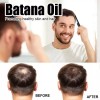Aceite De Batana De 60ml*3 Para El Crecimiento Del Cabello