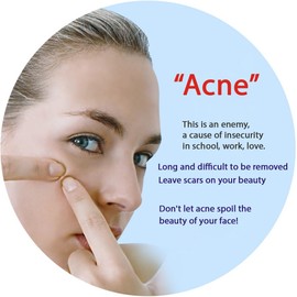 BIOAQUA PURESKIN - Acne & Rejuvenation Mask Sheet Treatment Face Rejuvenation Effective Removal Hamamelis Extract Nourishing Of (PACK OF 4 Mask Sheets = 4 x 30g)