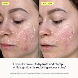 Skinfix Skin Barrier - Crema de gel restauradora de 1.7 onzas, hidratante no grasa para pieles normales a mixtas, hidrata, rellena y suaviza, no comed