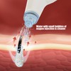 Vacuum Blackhead Removal Electric Pore Cleaner Blackhead Extractor Tool Face