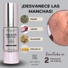 Aclara Manchas, Calma Y Protege Tu Piel Suero Azelaico 5%