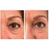 Instant Eye Bag Puffiness And Wrinkle Remover Cream For Women
