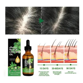 Aceite De Ricino,crecimiento De Pestañas, Cejas, Cabello 2pc