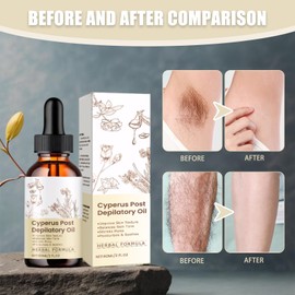 2 Bottles Cyperus Rotundus Oil Cyperus Rotundus 60ml/Bottle Cyprus Rotundus Oil Cyperus Oil Hair Removal Care Essential Oil Used to Inhibit Hair Growth, Moisturize and Soothe