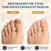Crema Para El Cuidado De Las Uñas,pomada Reparadora De Uñas