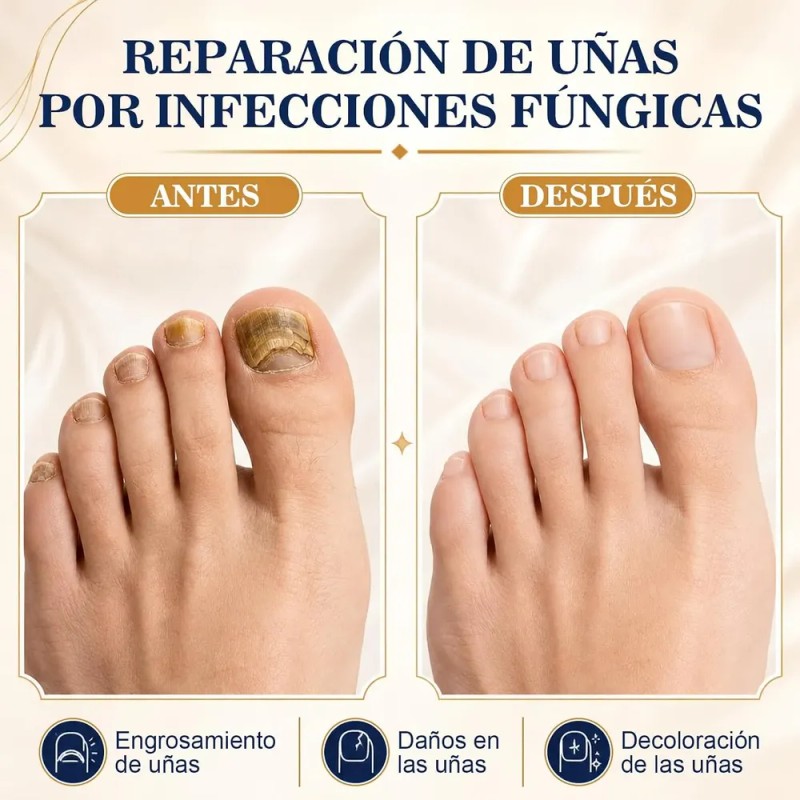Crema Para El Cuidado De Las Uñas,pomada Reparadora De Uñas