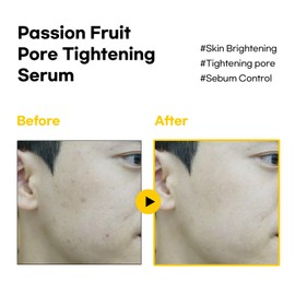 BBH Passion Fruit Pore Tightening Serum, Oily & Dry Skin 1.69 fl oz