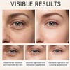 Vitamin C Eye Roller Serum for Dark Circles & Puffiness,Eye