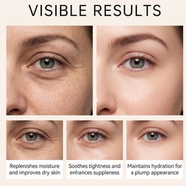 Vitamin C Eye Roller Serum for Dark Circles & Puffiness,Eye Bag Remover