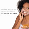 Neutrogena, Jabón Facial En Barra Antiacné 100 G