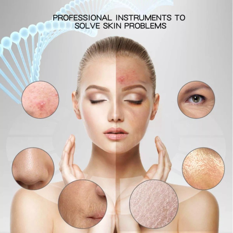 MYBEAUTY Limpiador Facial Peeling Ultrasónico Portatil Skin Scrubber